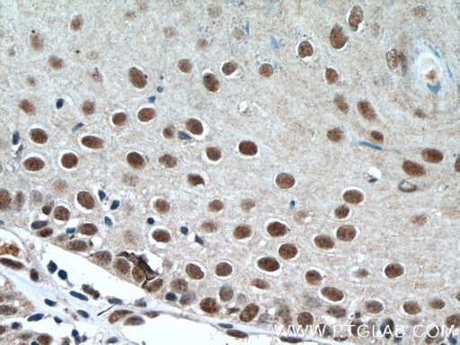 [13639-1-AP-150UL] DSS1 Polyclonal antibody