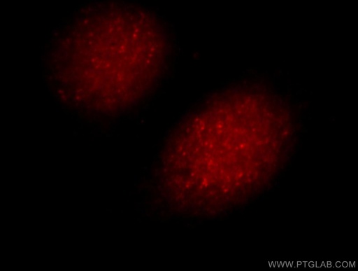 [13642-1-AP-150UL] UIMC1 Polyclonal antibody