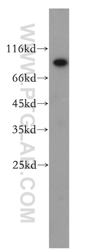 [13644-1-AP-20UL] TIGD5 Polyclonal antibody