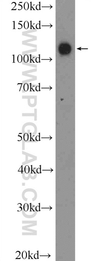 [13645-1-AP-150UL] PCDH1 Polyclonal antibody