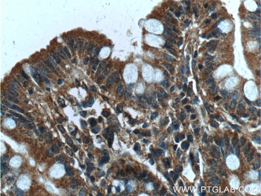 [13652-1-AP-150UL] NARFL Polyclonal antibody