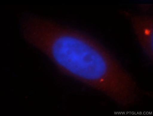 [13653-1-AP-20UL] DNASE1L1 Polyclonal antibody