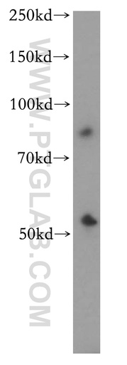 [13654-1-AP-150UL] CYP2S1 Polyclonal antibody