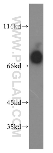 [13655-1-AP-150UL] IL-3RA Polyclonal antibody