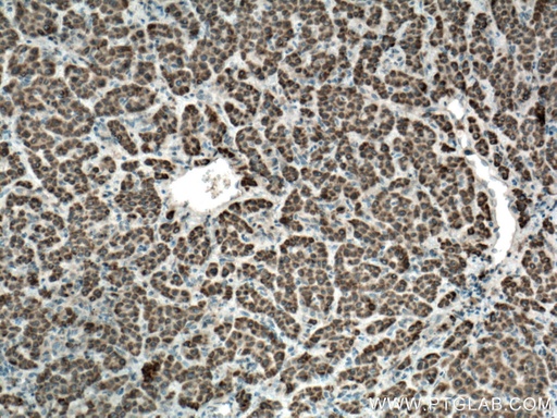 [13657-1-AP-20UL] SLC35A2 Polyclonal antibody