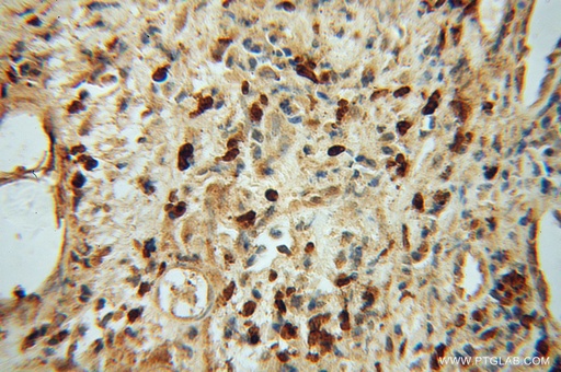 [13658-1-AP-20UL] NR2C1 Polyclonal antibody