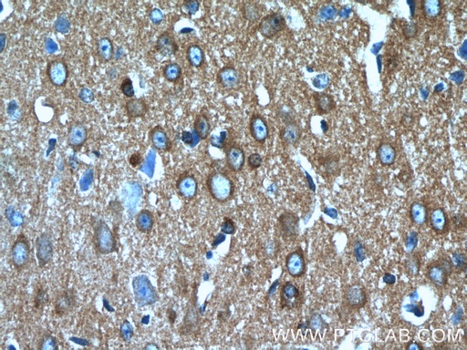 [13661-1-AP-20UL] CRMP4 Polyclonal antibody