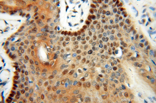 [13662-1-AP-20UL] LTA4H Polyclonal antibody