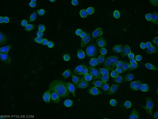 [13663-1-AP-20UL] TRIM17 Polyclonal antibody