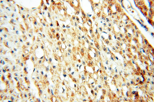 [13664-1-AP-20UL] SFTPB Polyclonal antibody