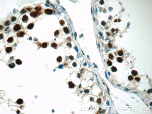 [13665-1-AP-150UL] CTNNBL1 Polyclonal antibody