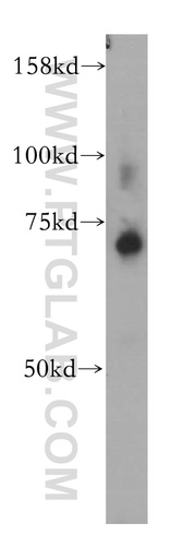 [13667-1-AP-150UL] ZNF443 Polyclonal antibody