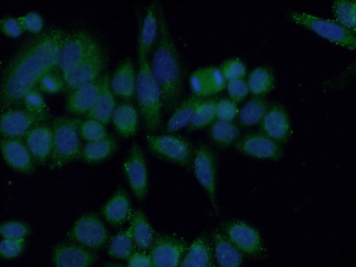 [13670-1-AP-150UL] CA7 Polyclonal antibody