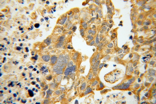 [13672-1-AP-150UL] ATP11B Polyclonal antibody