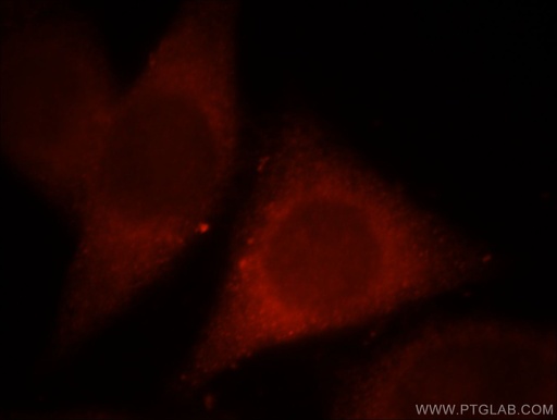 [13677-1-AP-150UL] MPPED1 Polyclonal antibody