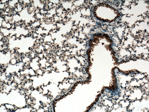 [13679-1-AP-20UL] PIGA Polyclonal antibody