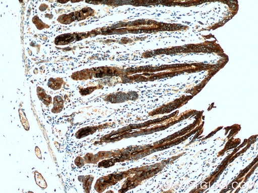 [13681-1-AP-150UL] TFF2 Polyclonal antibody