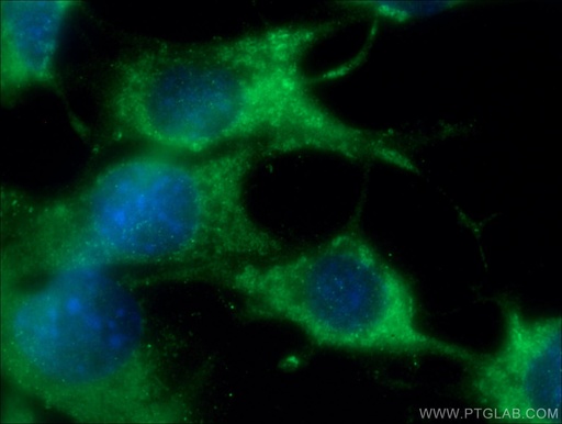 [13683-1-AP-20UL] CHMP4B Polyclonal antibody