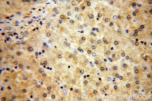 [13684-1-AP-20UL] MTMR6 Polyclonal antibody