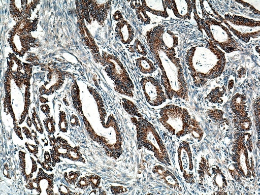 [13685-1-AP-20UL] BCKDHB Polyclonal antibody