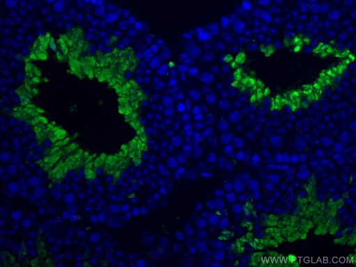 [13686-1-AP-20UL] PGK2 Polyclonal antibody