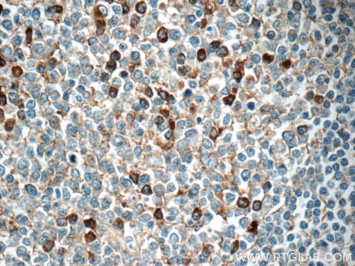 [13688-1-AP-20UL] IGJ Polyclonal antibody