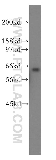 [13694-1-AP-150UL] SSX2IP Polyclonal antibody