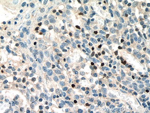 [13700-1-AP-20UL] TBX21,T-bet Polyclonal antibody