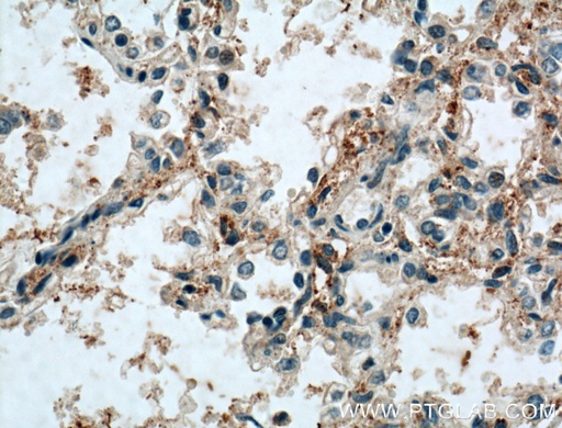 [13702-1-AP-150UL] SCARF1 Polyclonal antibody