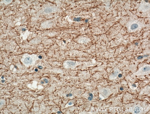 [13705-1-AP-20UL] DGCR2 Polyclonal antibody