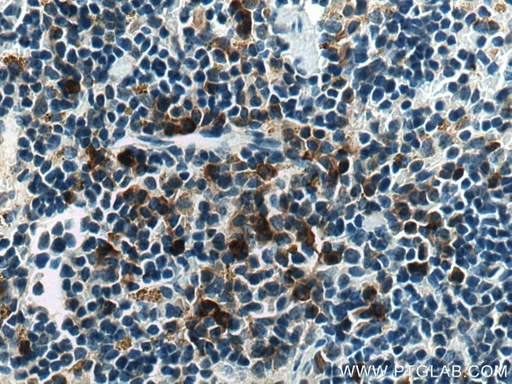 [13706-1-AP-20UL] ADAP2 Polyclonal antibody
