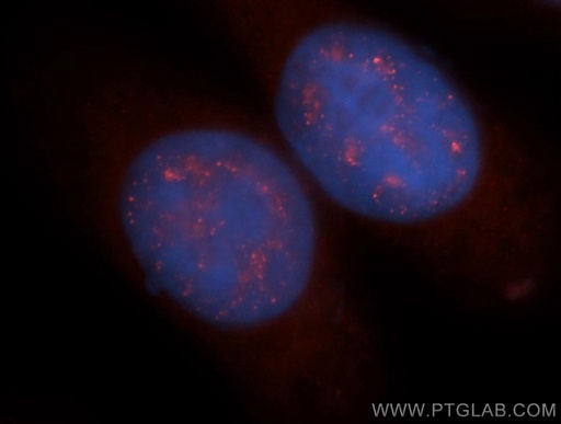 [13709-1-AP-150UL] TCP10L Polyclonal antibody