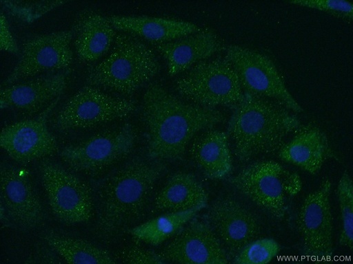[13710-1-AP-20UL] Carboxypeptidase E Polyclonal antibody