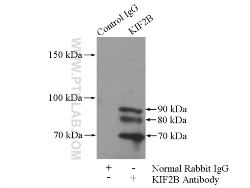 [13711-1-AP-150UL] KIF2B Polyclonal antibody
