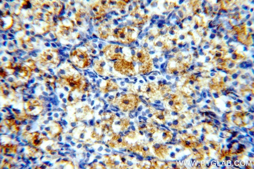 [13712-1-AP-20UL] PNCK Polyclonal antibody