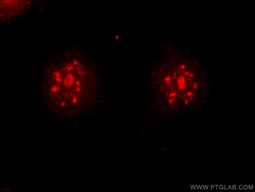 [13714-1-AP-150UL] DMC1 Polyclonal antibody
