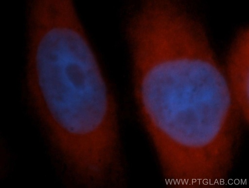 [13722-1-AP-150UL] TTF2 Polyclonal antibody