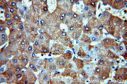 [13725-1-AP-20UL] CBR4 Polyclonal antibody