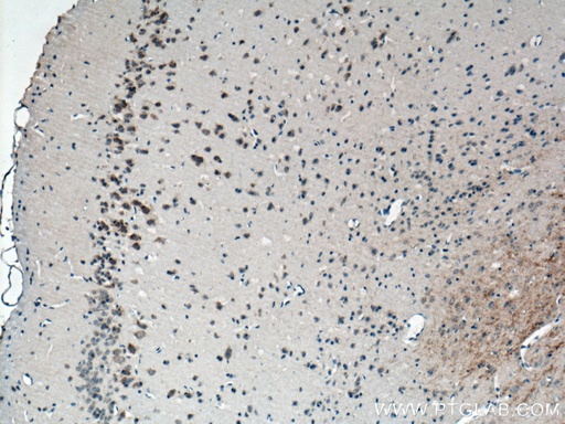 [13729-1-AP-150UL] CACNG3 Polyclonal antibody