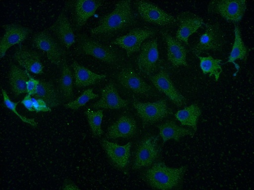 [13730-1-AP-20UL] CAMK2 Polyclonal antibody