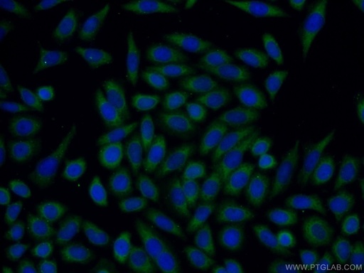 [13734-1-AP-20UL] Trefoil factor 1 Polyclonal antibody