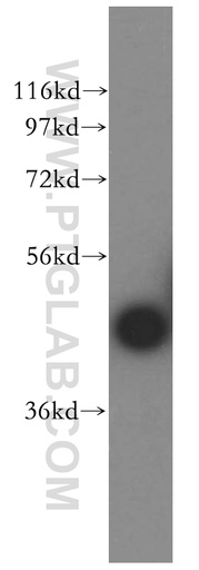 [13736-1-AP-150UL] CA14 Polyclonal antibody