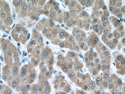 [13737-1-AP-20UL] CYP3A5 Polyclonal antibody