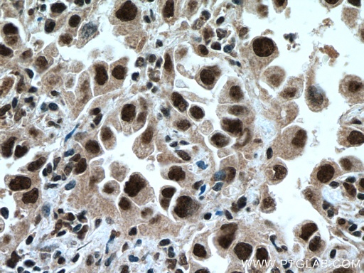 [13744-1-AP-150UL] TRIM22 Polyclonal antibody
