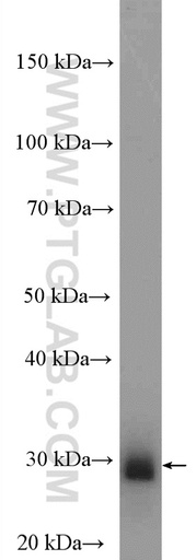 [13748-1-AP-150UL] KCNIP4 Polyclonal antibody