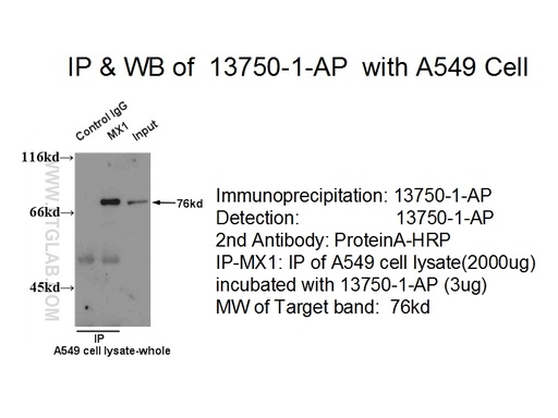 [13750-1-AP-150UL] MX1 Polyclonal antibody