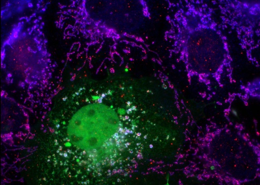[13753-1-AP-20UL] RNase T2 Polyclonal antibody