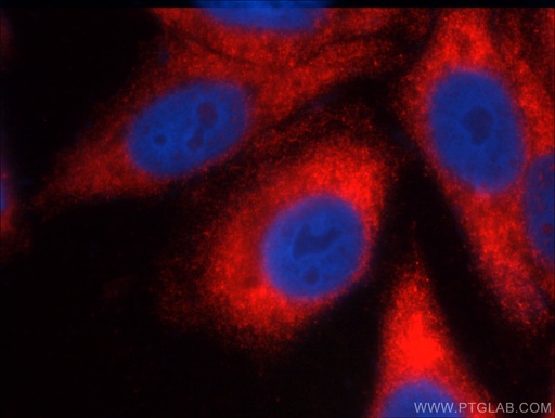 [13755-1-AP-150UL] FMR1 Polyclonal antibody