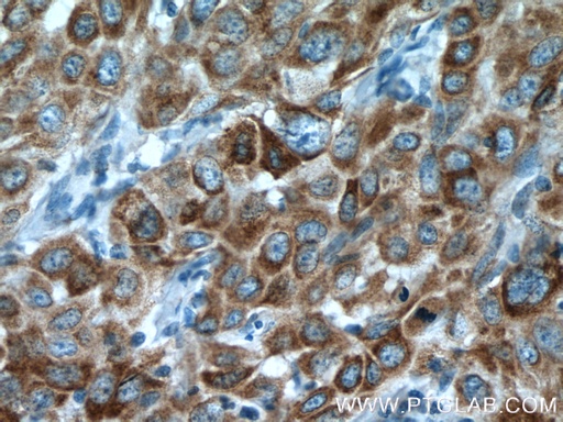 [13759-1-AP-20UL] P4HA2 Polyclonal antibody