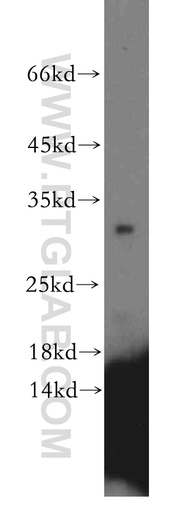 [13760-1-AP-20UL] CRYBB1 Polyclonal antibody